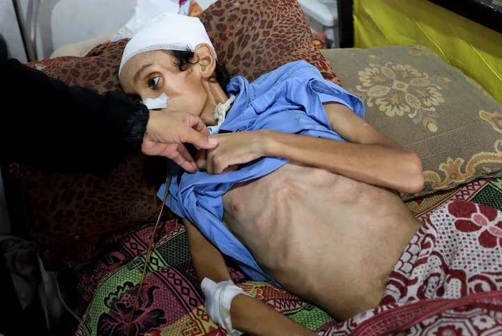 Over 100 NGOs demand immediate ceasefire in Gaza, warn of 'mass starvation' due to Israel's blockade