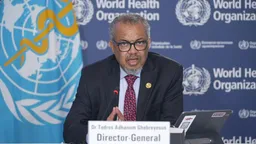 'Deadly surge' in malnutrition-related deaths in Gaza: WHO chief