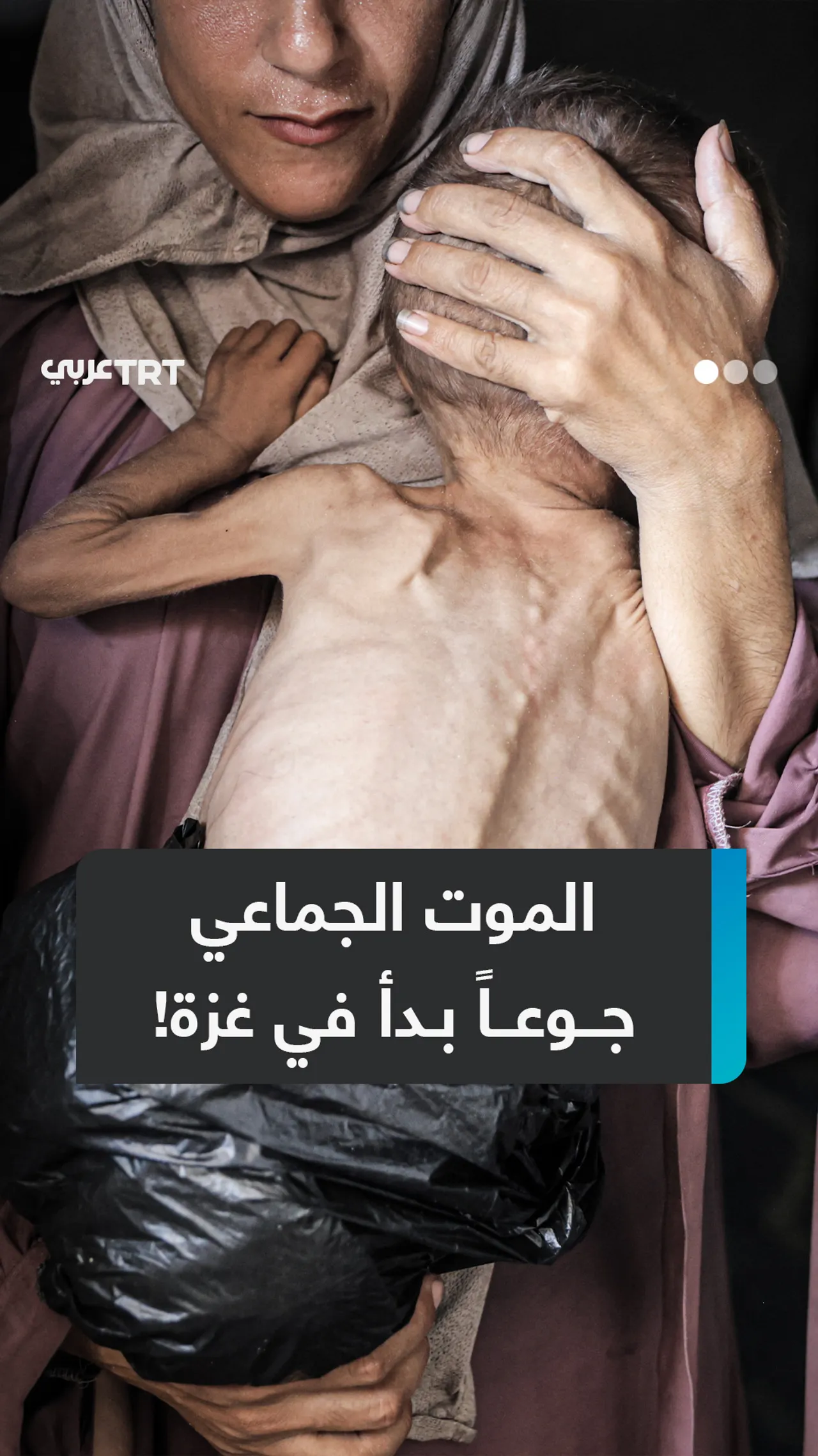 وكالة عالمية: مراسلونا سيموتون جوعاً!