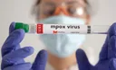 Mpox remains 'health emergency' in Africa