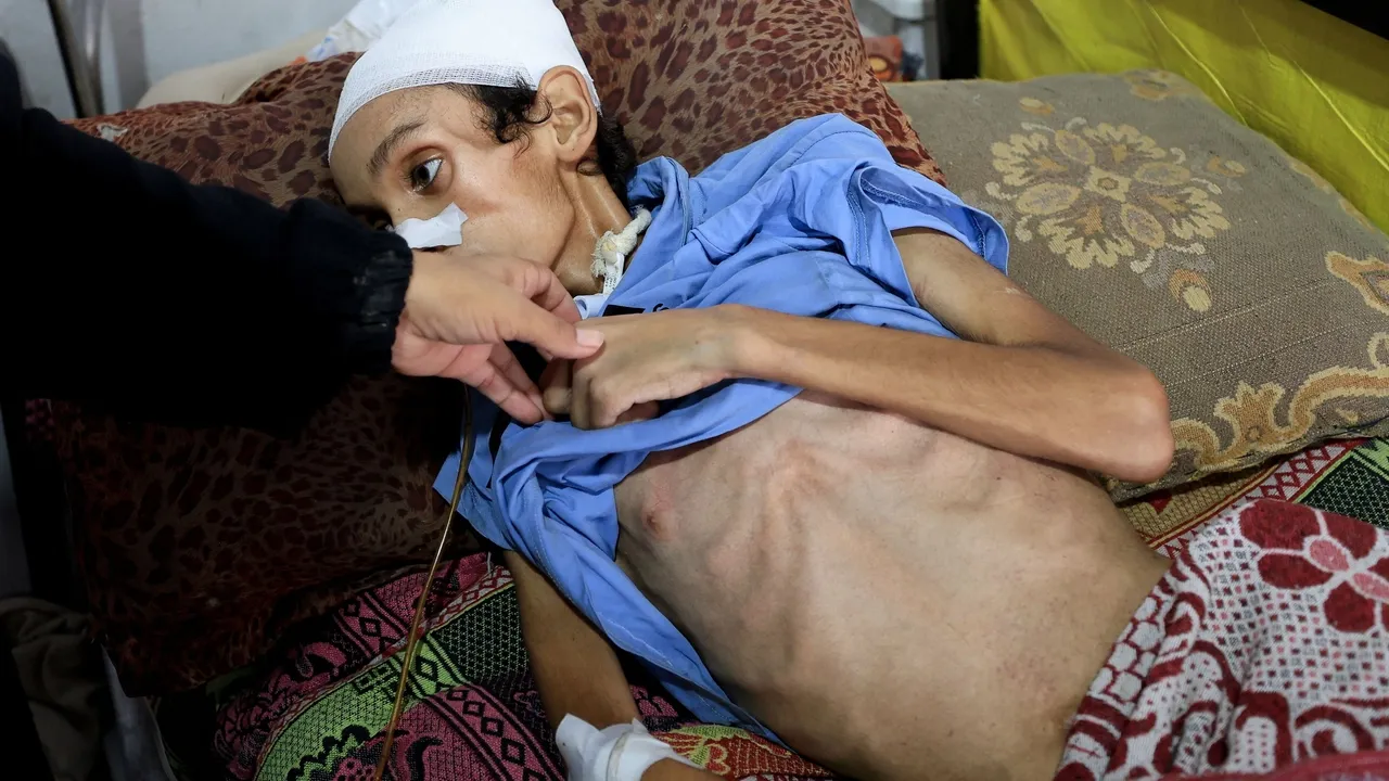 Mais de 100 ONGs exigem um cessar-fogo imediato em Gaza e alertam para 'fome em massa'