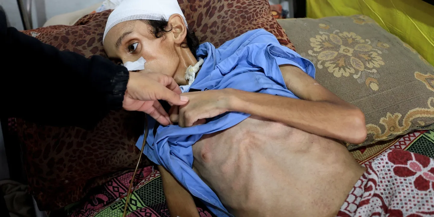 Mais de 100 ONGs exigem um cessar-fogo imediato em Gaza e alertam para 'fome em massa'