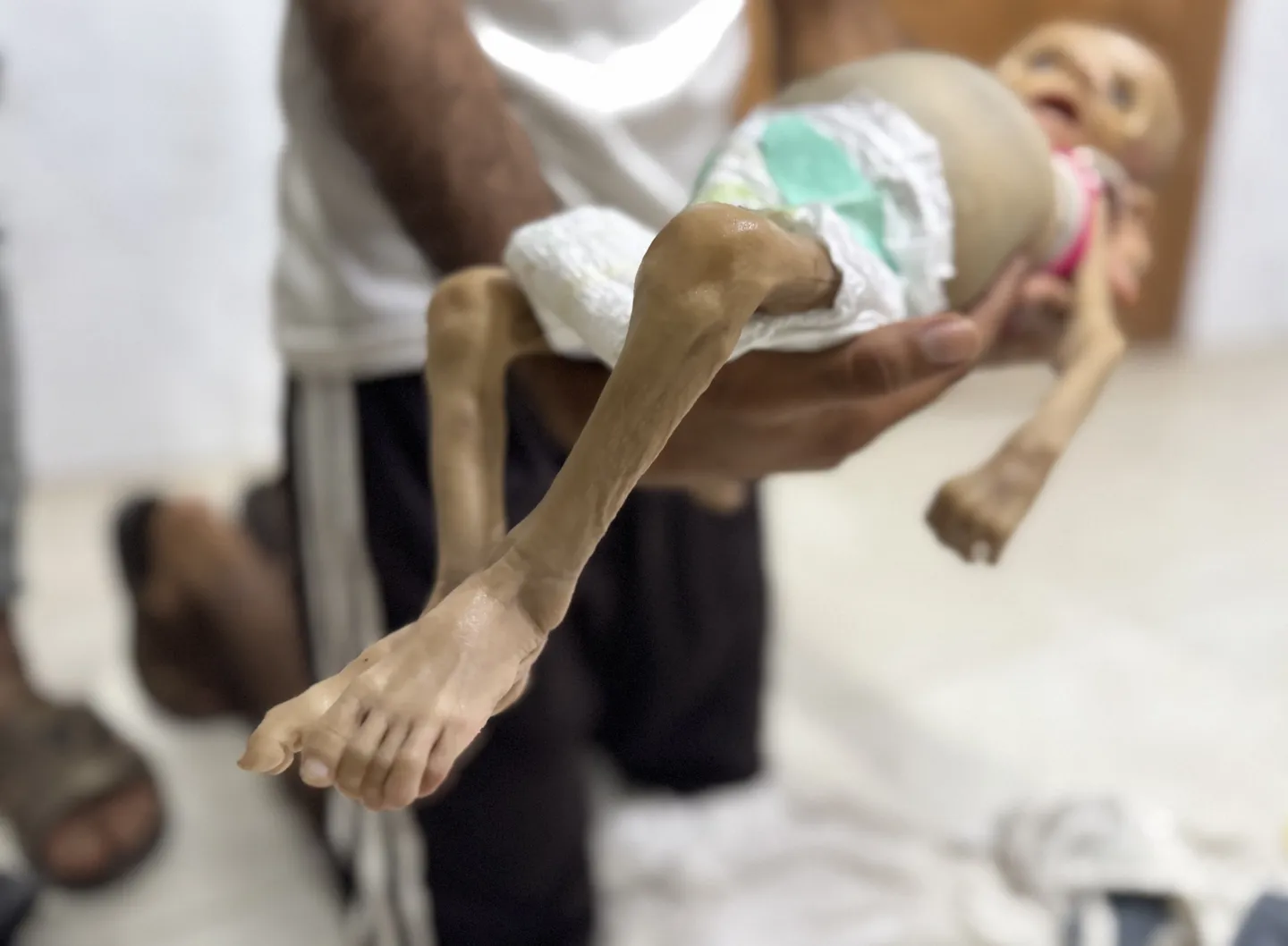 "جلدها التصق بعظمها".. رضيعة فلسطينية تفارق الحياة بسبب سياسة التجويع الإسرائيلية في غزة