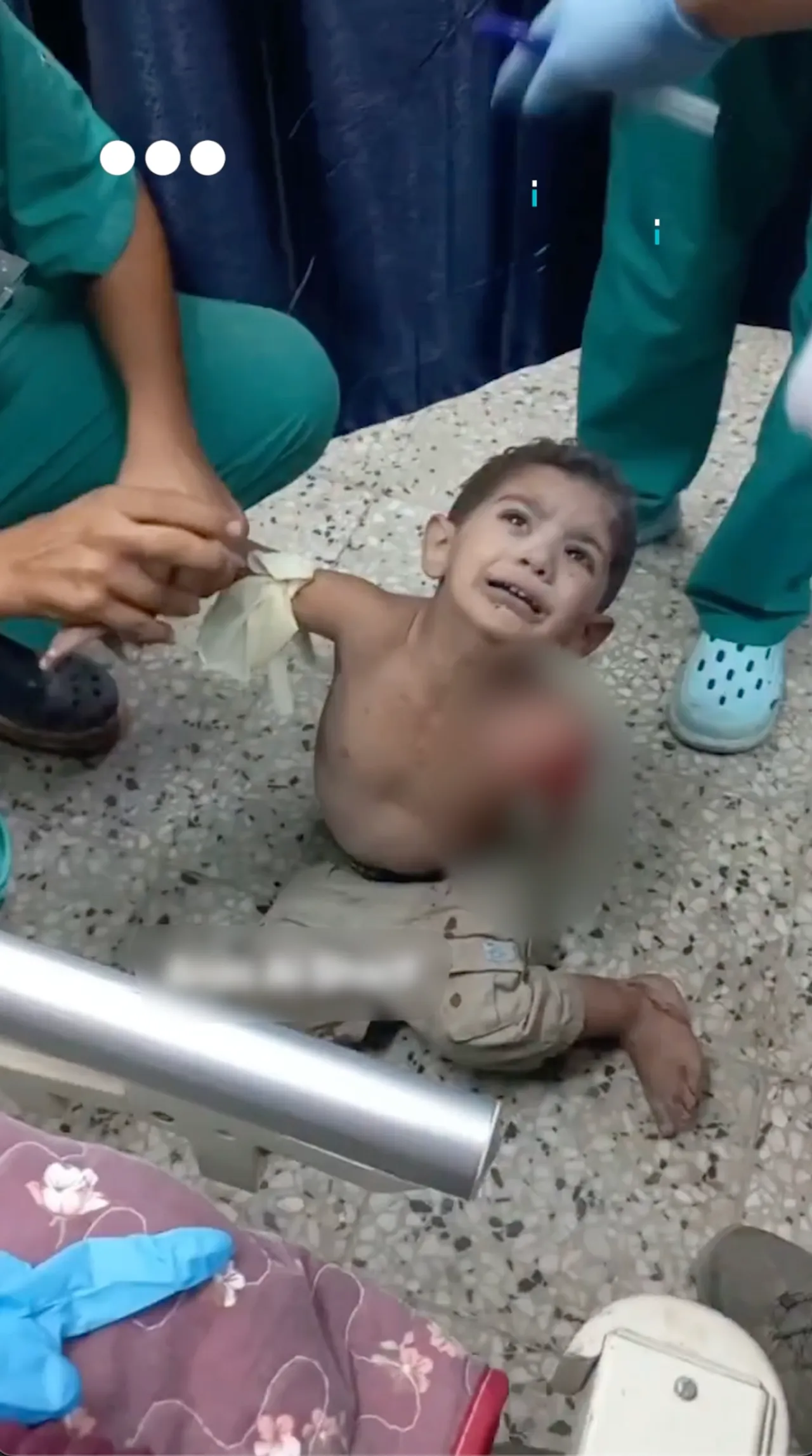 Palestinian child loses his arm in Israeli strike on Gaza school