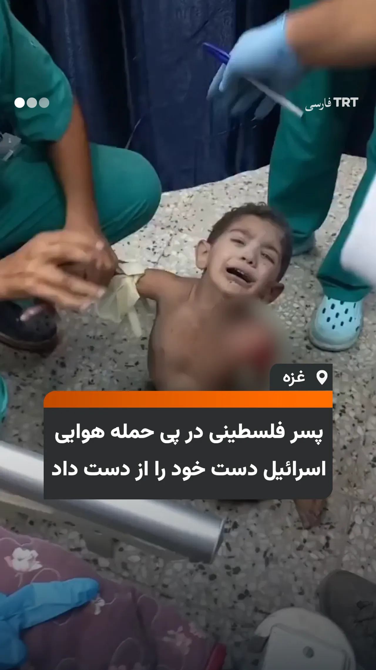 پسر فلسطینی در پی حمله هوایی اسرائیل دست خود را از دست داد