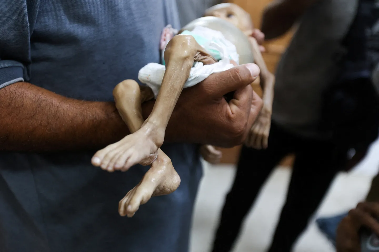 Israel kills another Palestinian baby under its Gaza starvation policy