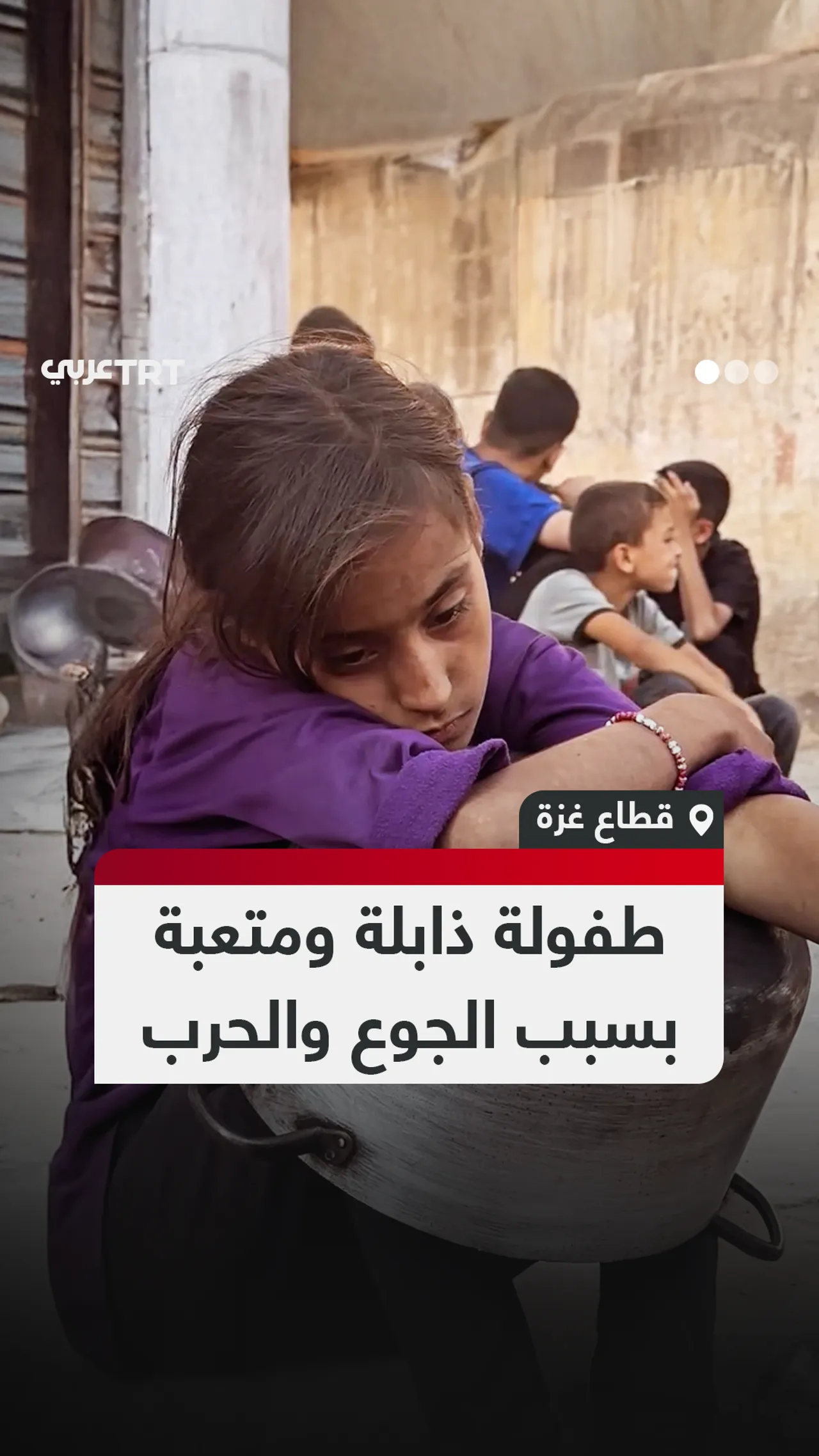 طفولة ذابلة ومتعبة بسبب الجوع والحرب