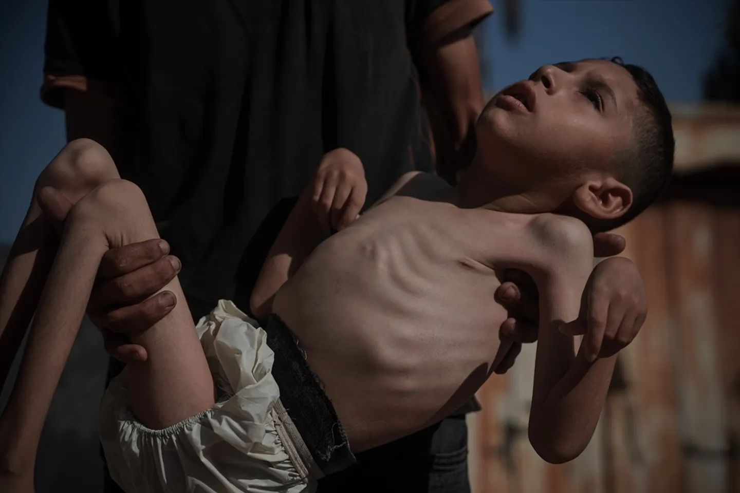 Još 14 Palestinaca, uključujući dvoje djece, umrlo od gladi u posljednja 24 sata u Gazi
