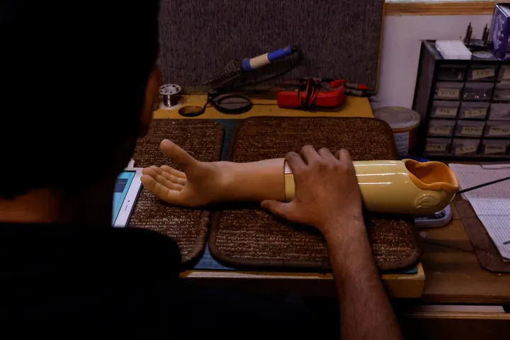 A Pakistani startup delivers hope with prosthetics for Gaza’s children