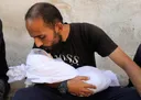 Cuando los niños escriben su testamento: Israel mata a la infancia en Gaza con amputaciones y hambre