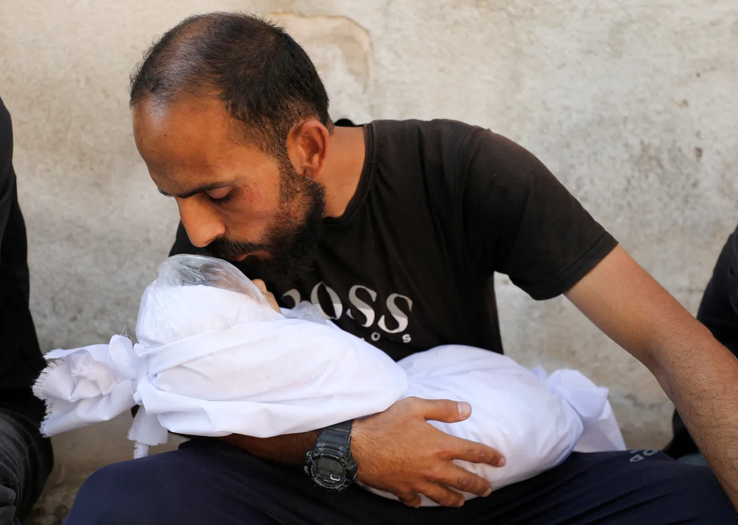 Cuando los niños escriben su testamento: Israel mata a la infancia en Gaza con amputaciones y hambre