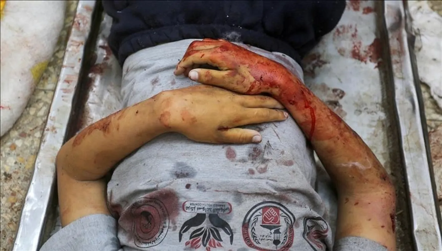 Mjekët pa Kufij: Vdekjet e fëmijëve nën 5 vjeç në Gaza janë dhjetëfishuar që nga 7 tetori 2023