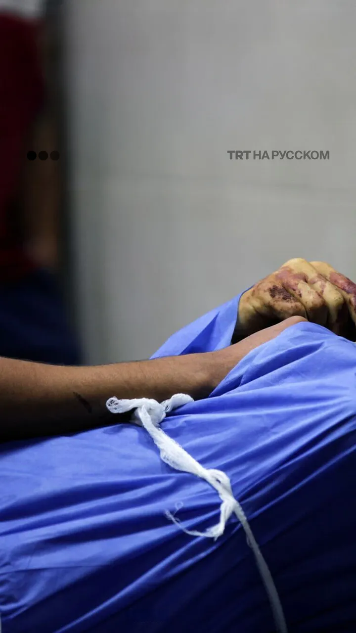 100 часов террора: сотни убитых и тысячи раненых в газе за прошедшие сутки