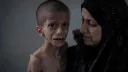عشرات الشهداء والجرحى بقصف الاحتلال على غزة.. والمجاعة في غزة تفتك بـ217 فلسطينياً بينهم 100 طفل