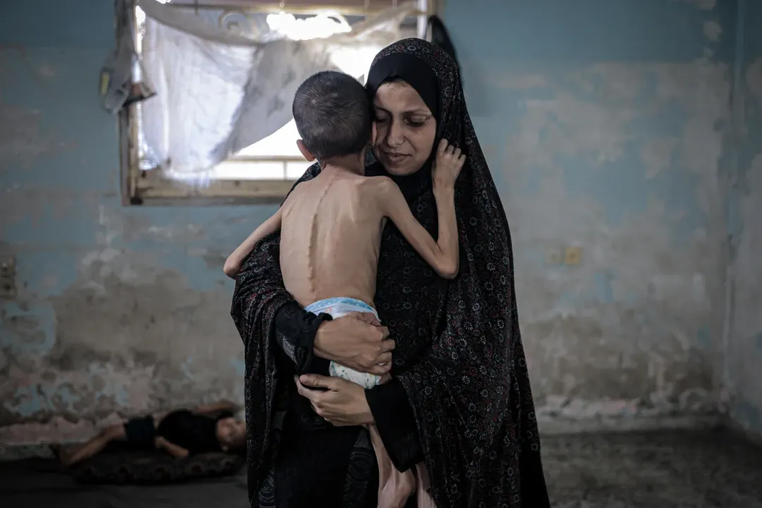 Gaza, entre bombardeos y hambruna: la tragedia de un niño de 5 años que murió pesando solo 3 kilos