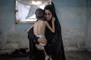 Vdes nga uria 5-vjeçari me aftësi të kufizuara në Gaza