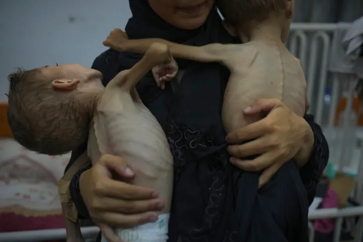 UNRWA: Mbi 100 fëmijë kanë vdekur nga uria në Gazën e rrethuar