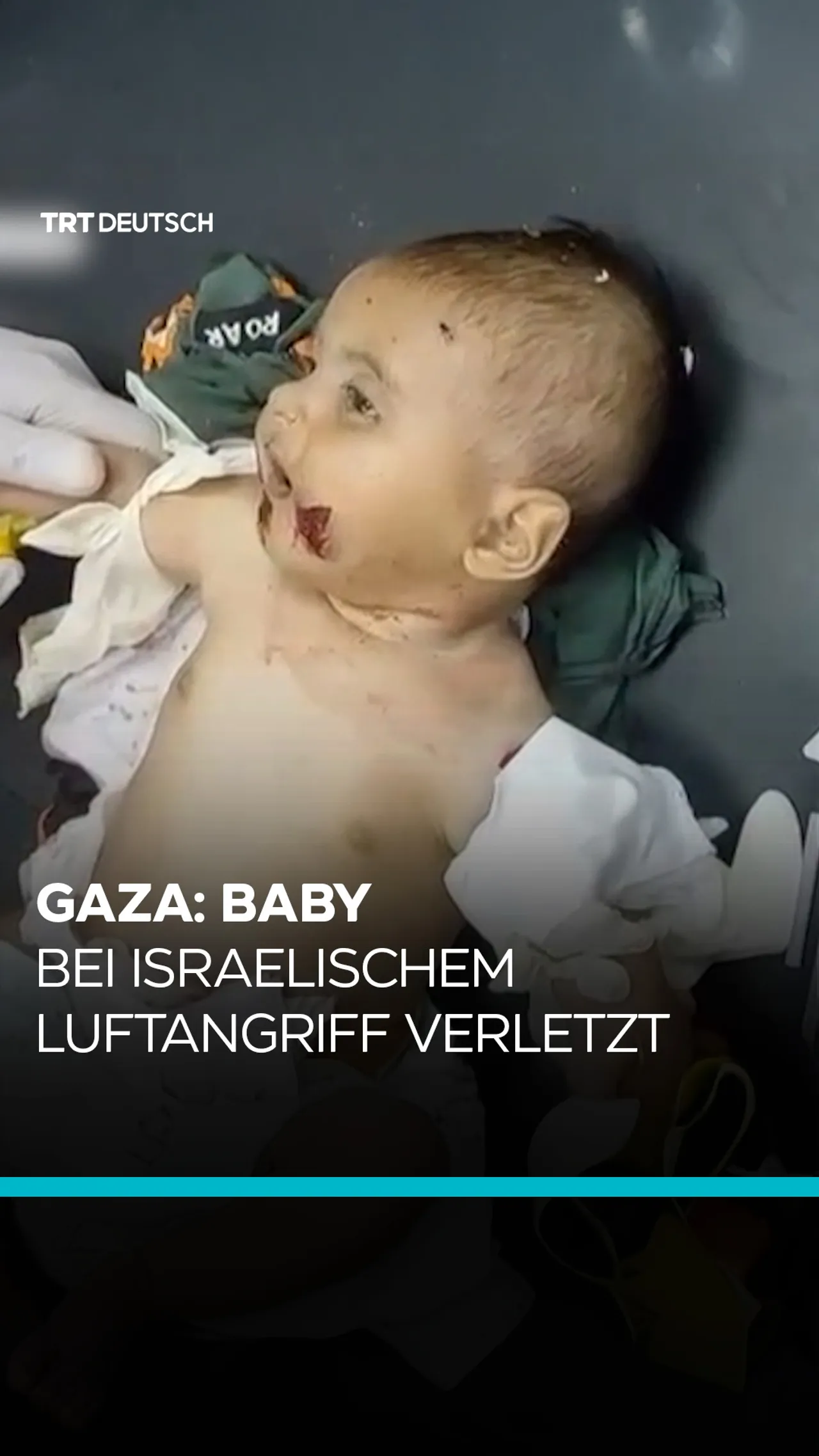 Gaza: Baby bei israelischem Luftangriff verletzt