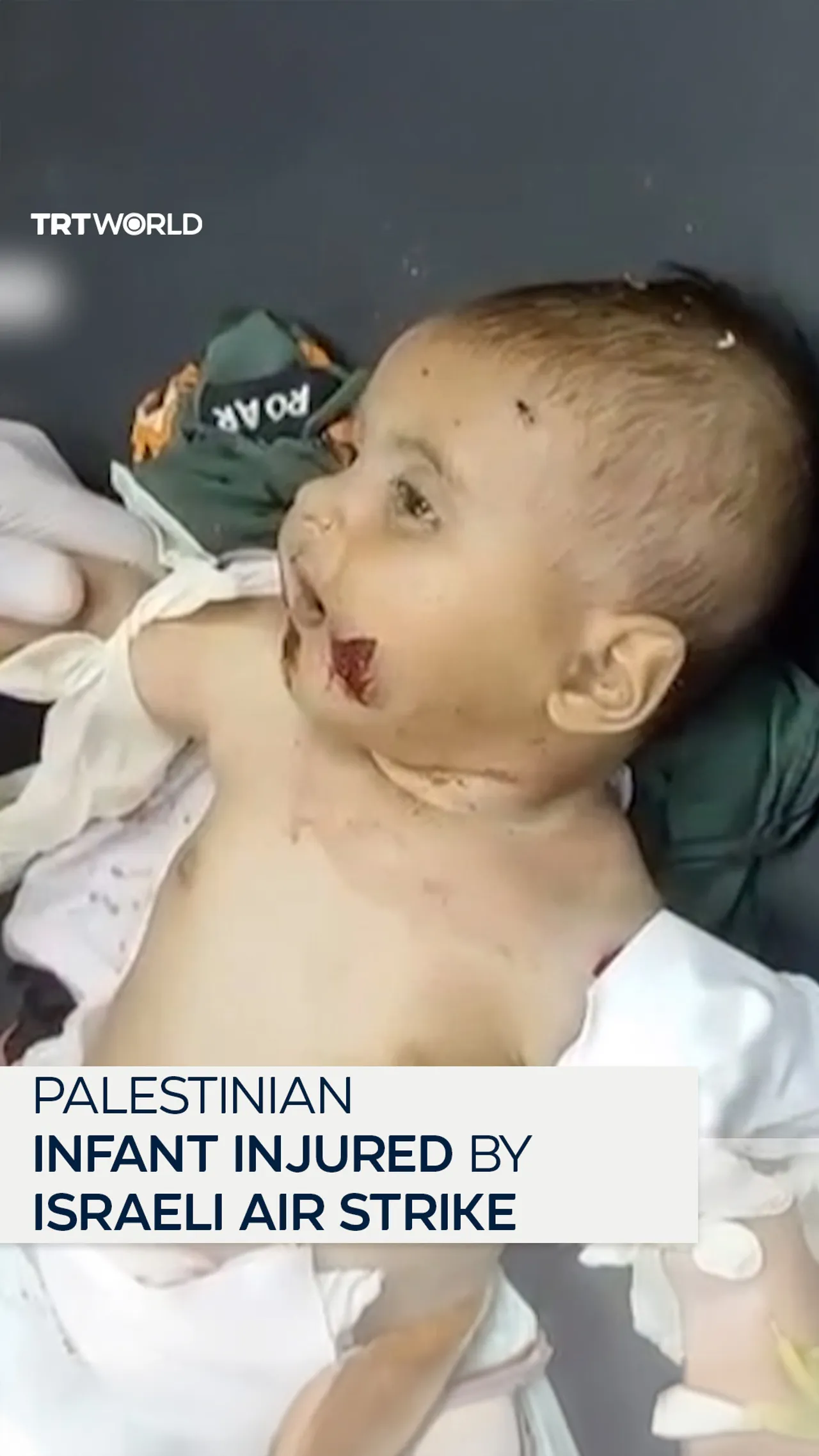 Palestinian infant injured in Israeli air strike on Khan Younis