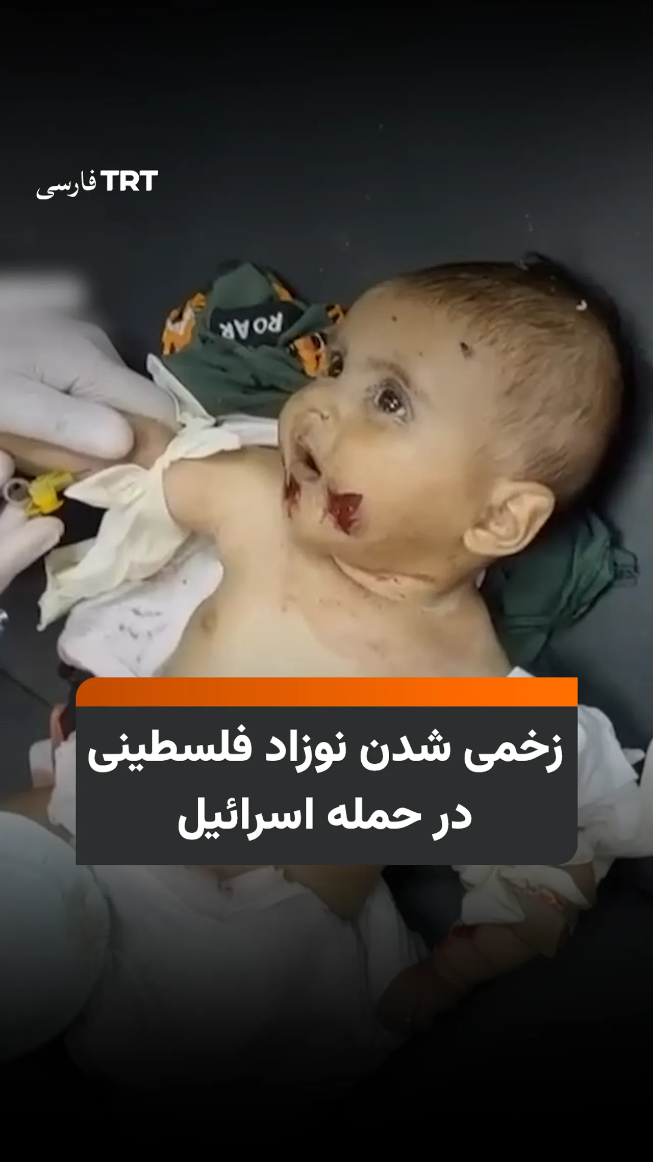 زخمی شدن نوزاد فلسطینی در حمله اسرائیل