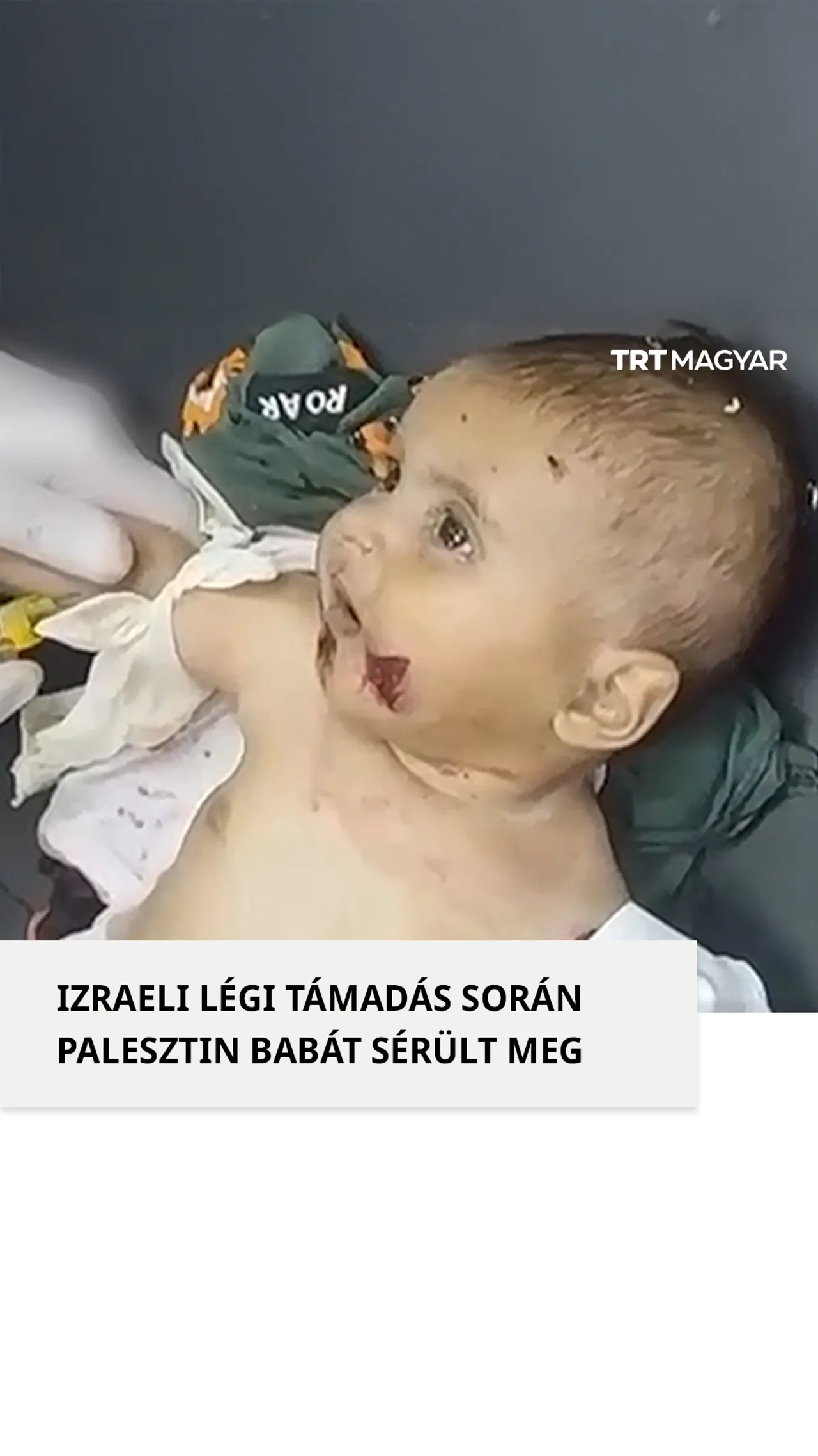 Egy palesztin csecsemő megsérült egy Han Yunusban történt izraeli légitámadásban