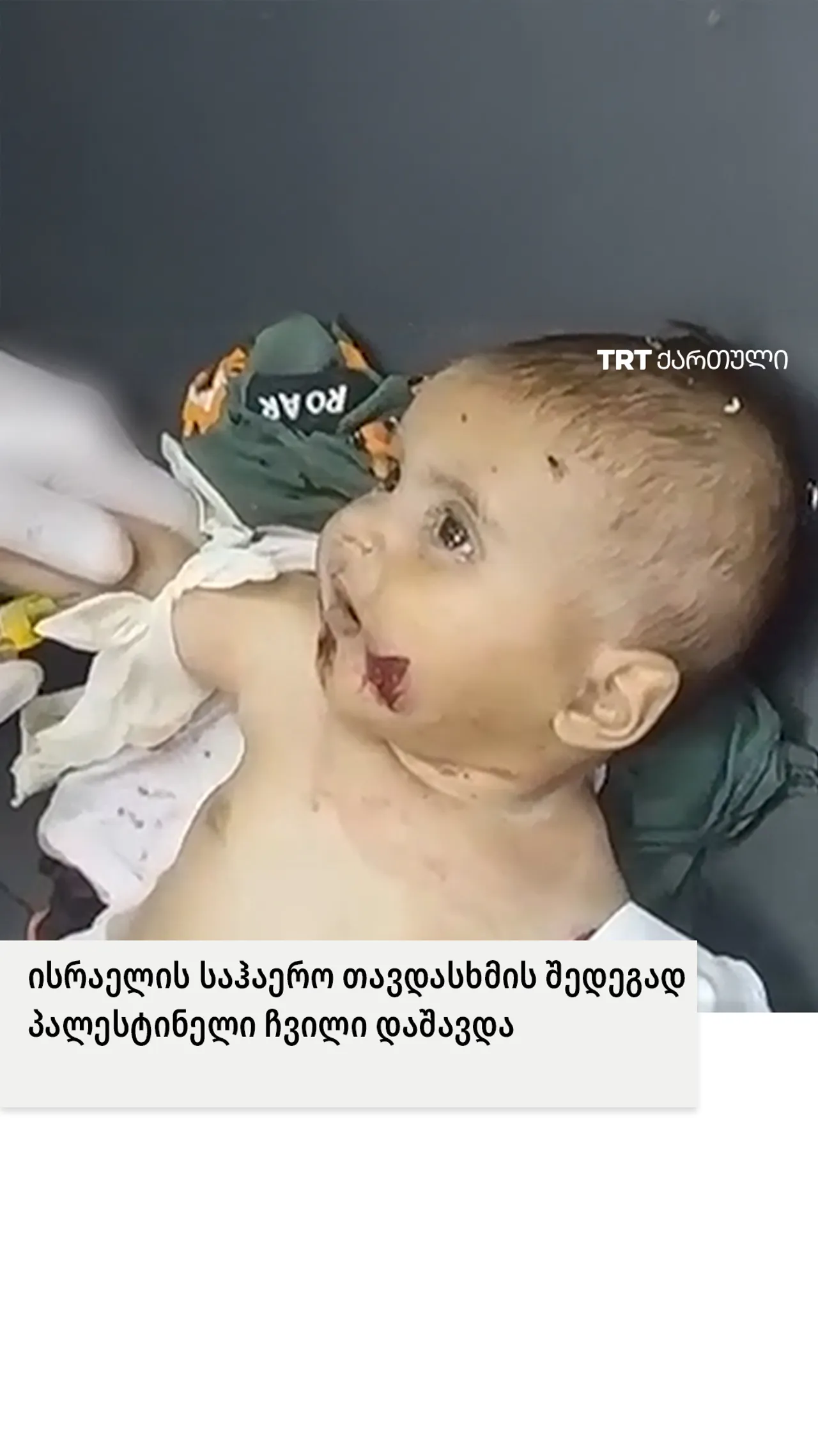 ისრაელის საჰაერო თავდასხმის შედეგად პალესტინელი ჩვილი დაშავდა