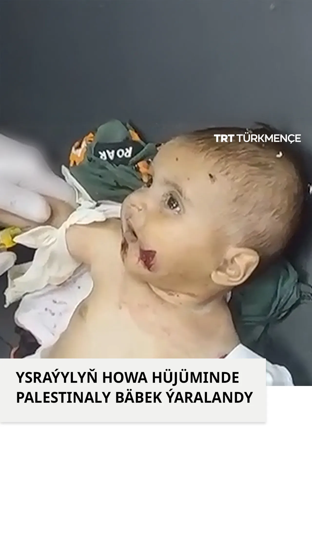 YSRAÝYLYŇ HOWA HÜJÜMINDE PALESTINALY BÄBEK ÝARALANDY