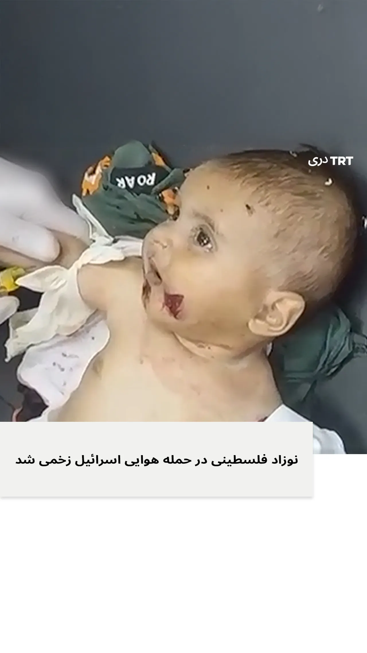 نوزاد فلسطینی در حمله هوایی اسرائیل زخمی شد