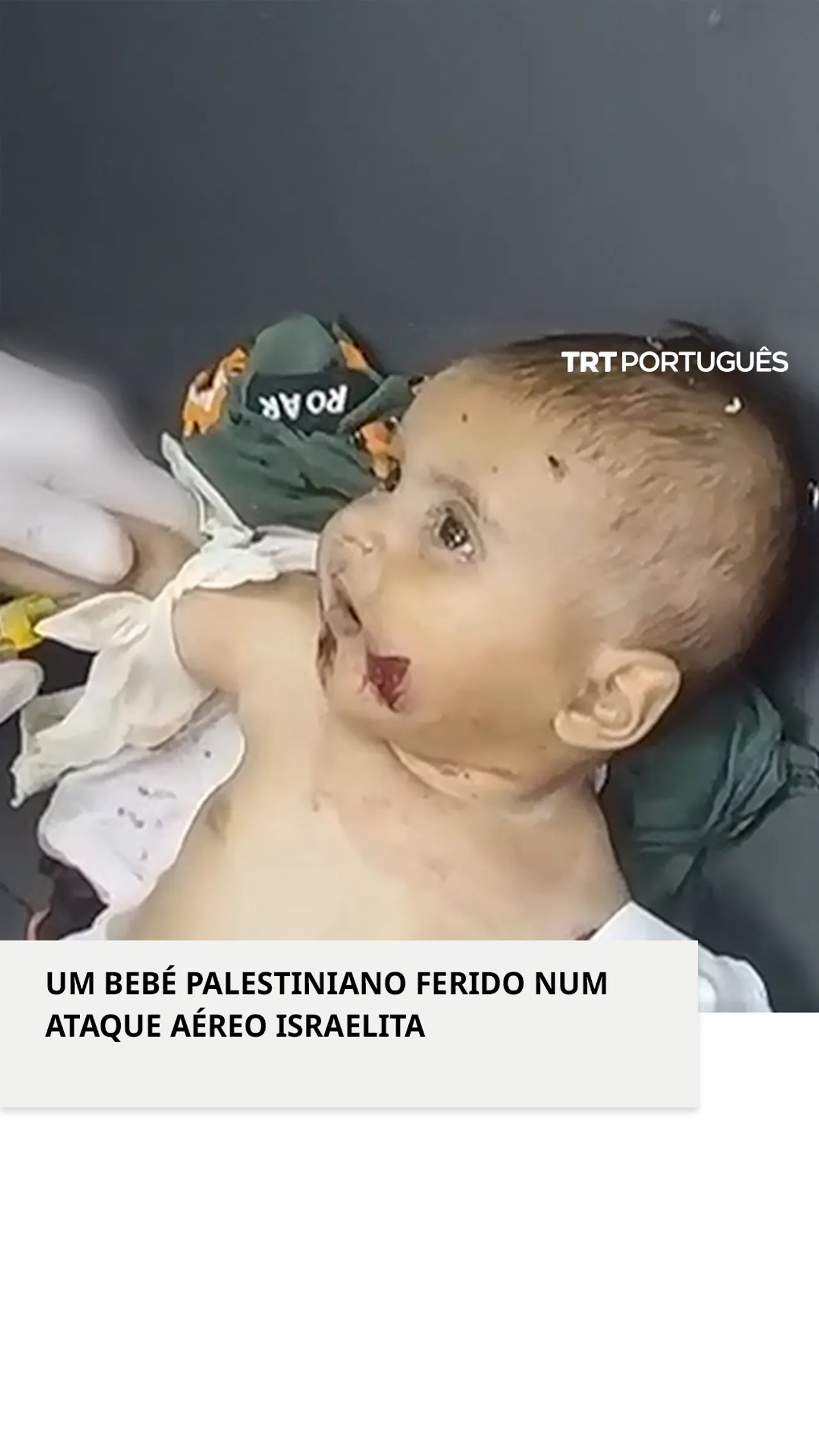 Um bebé palestiniano ficou ferido num ataque aéreo israelita em Khan Yunis