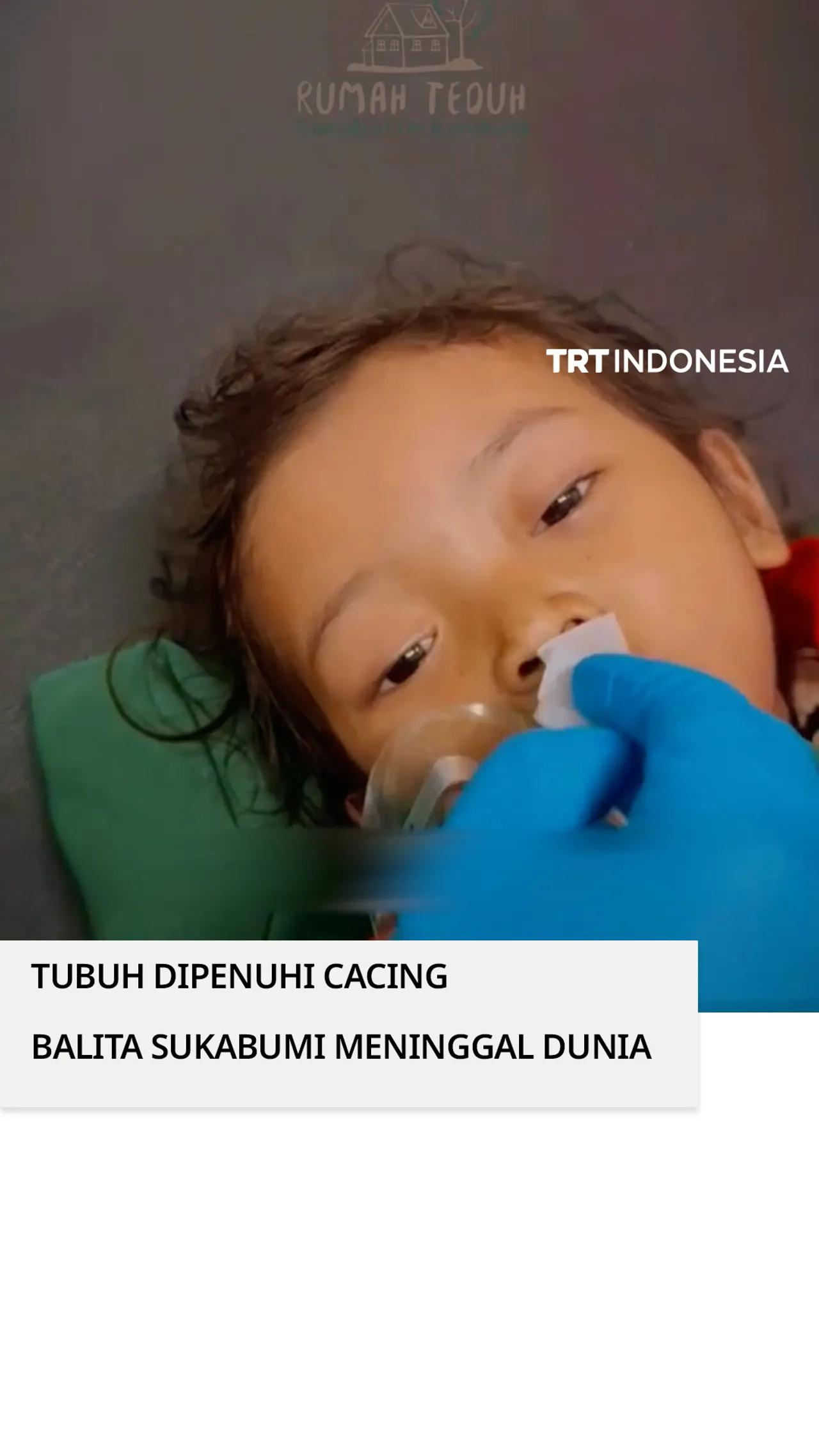 RSUD ungkap kondisi balita 3 tahun asal Sukabumi yang tubuhnya dipenuhi cacing hingga otak