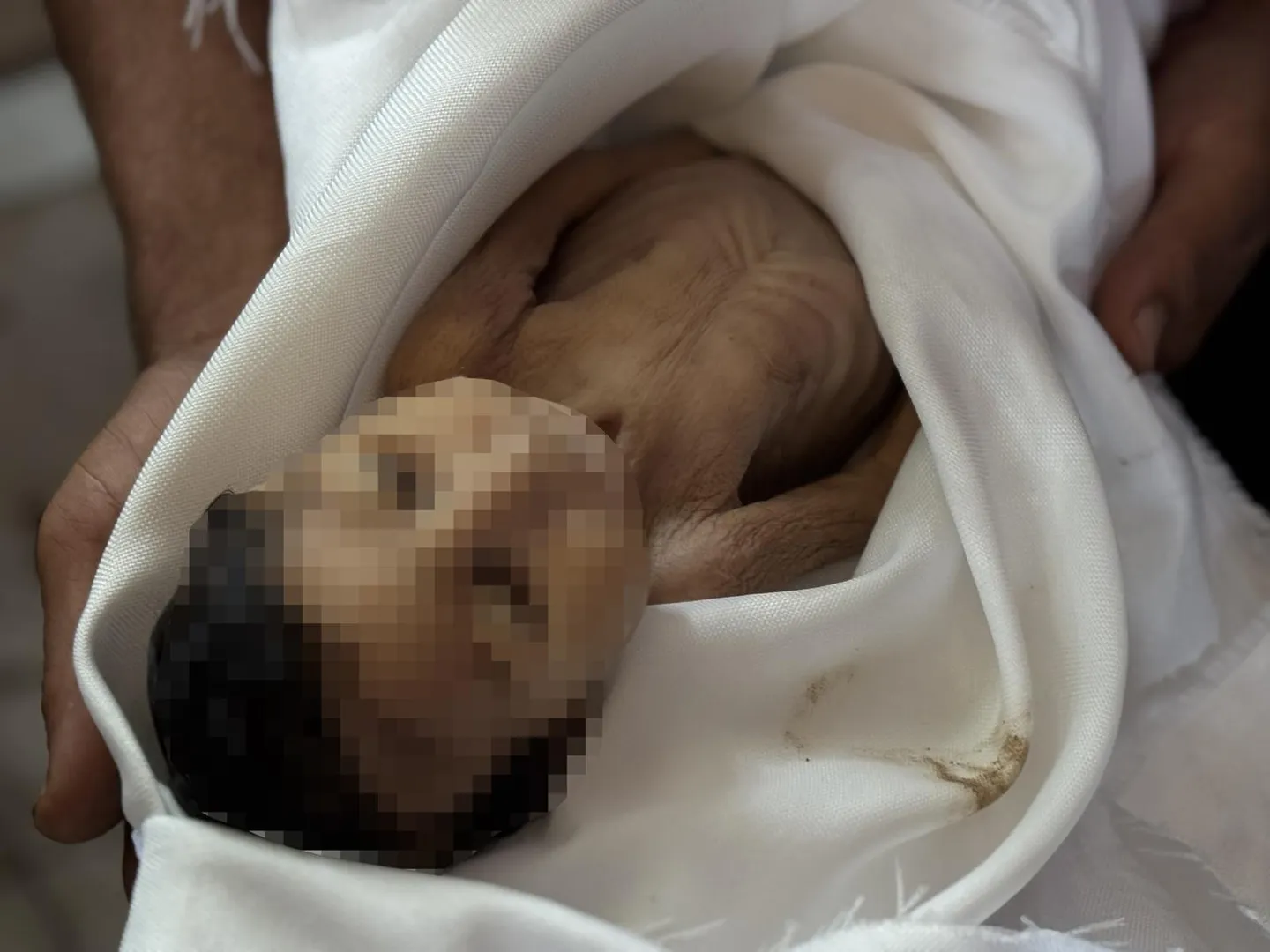 Një tjetër foshnje 5-muajshe vdes nga uria në Gaza, ku Izraeli ka shkaktuar zi buke