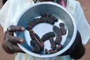Sudan war: Medics say children dying of malnutrition in South Kordofan