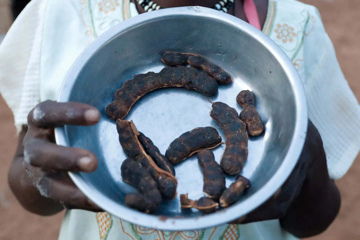 Sudan war: Medics say children dying of malnutrition in South Kordofan