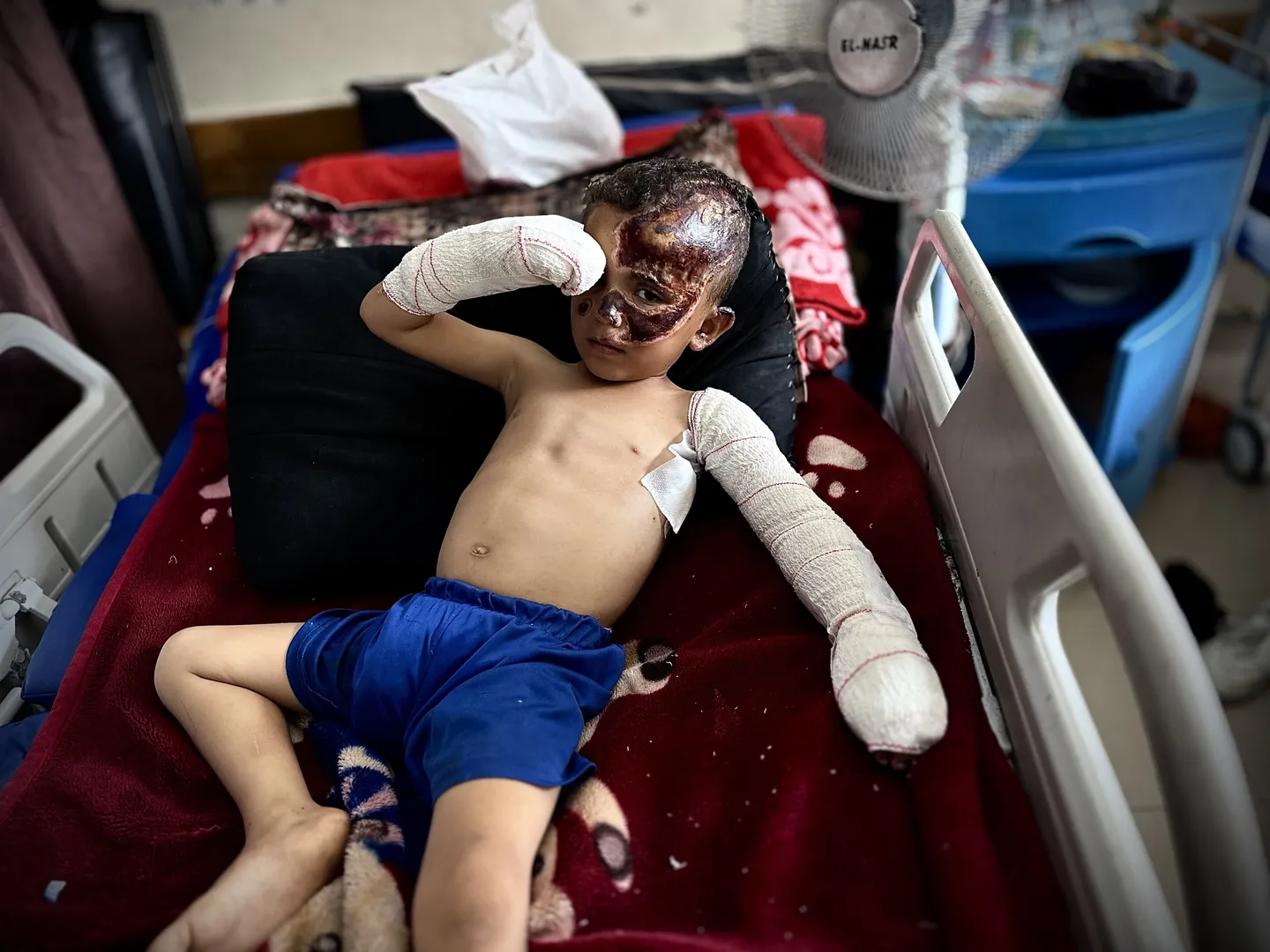 وزارت بهداشت فلسطین در غزه: اکنون زمان اقدام است، نه توضیح