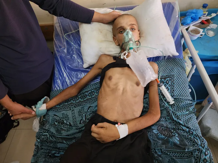 Starving Gaza children too weak to cry, NGO head tells UN meeting