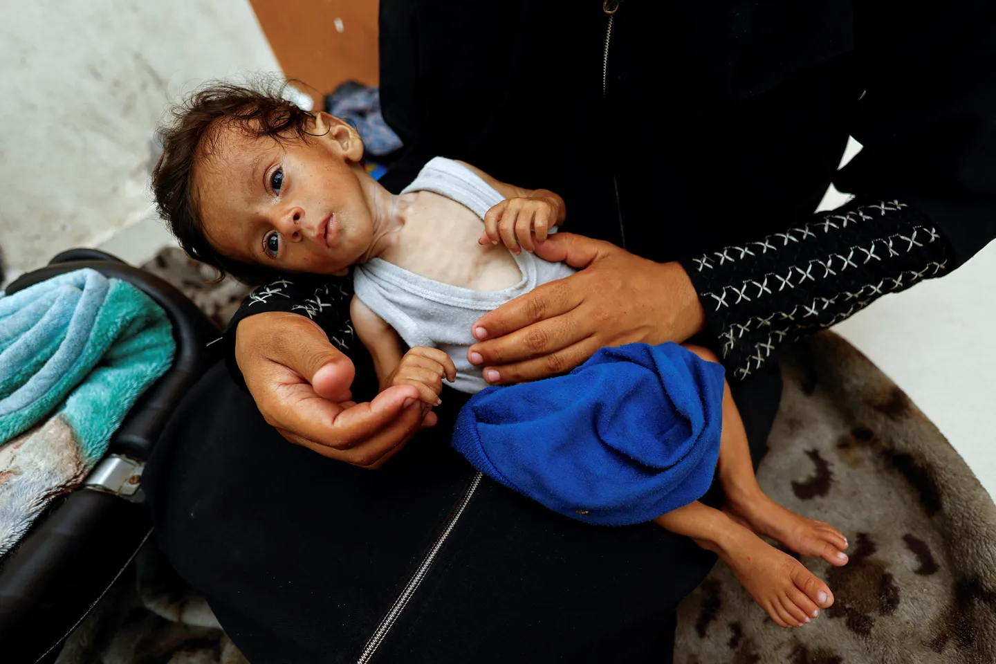 Save the children: Izgladnjela djeca Gaze preslaba su da bi i plakala