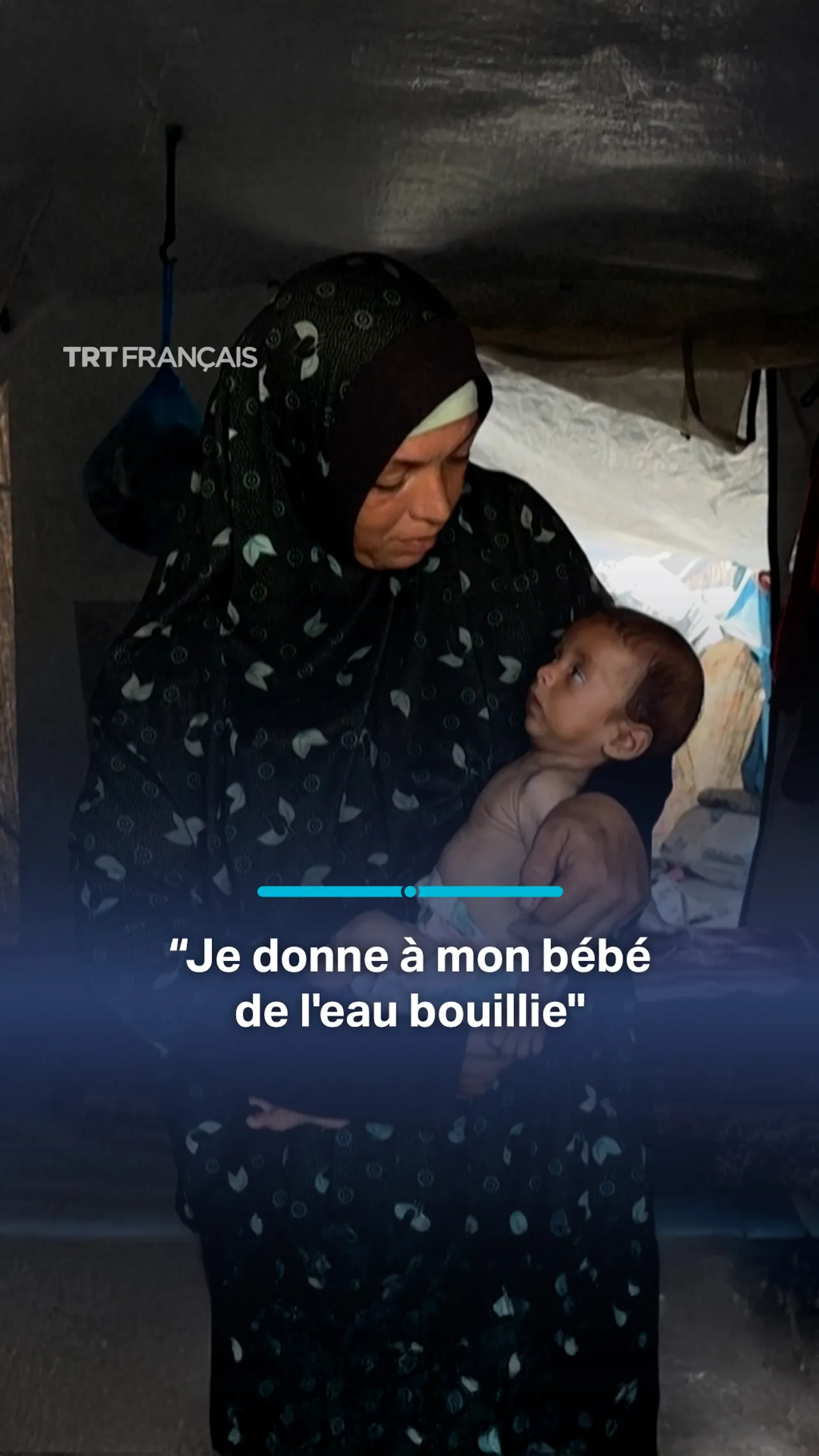 À Gaza, un bébé de cinq mois souffre de malnutrition après un déplacement forcé