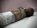 Još jedna beba u Gazi preminula zbog pothranjenosti