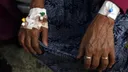 Maambukizi zaidi 100,000 ya kipindupindu Sudan ndani ya mwaka 1 huku kukiwa na njaa: UN