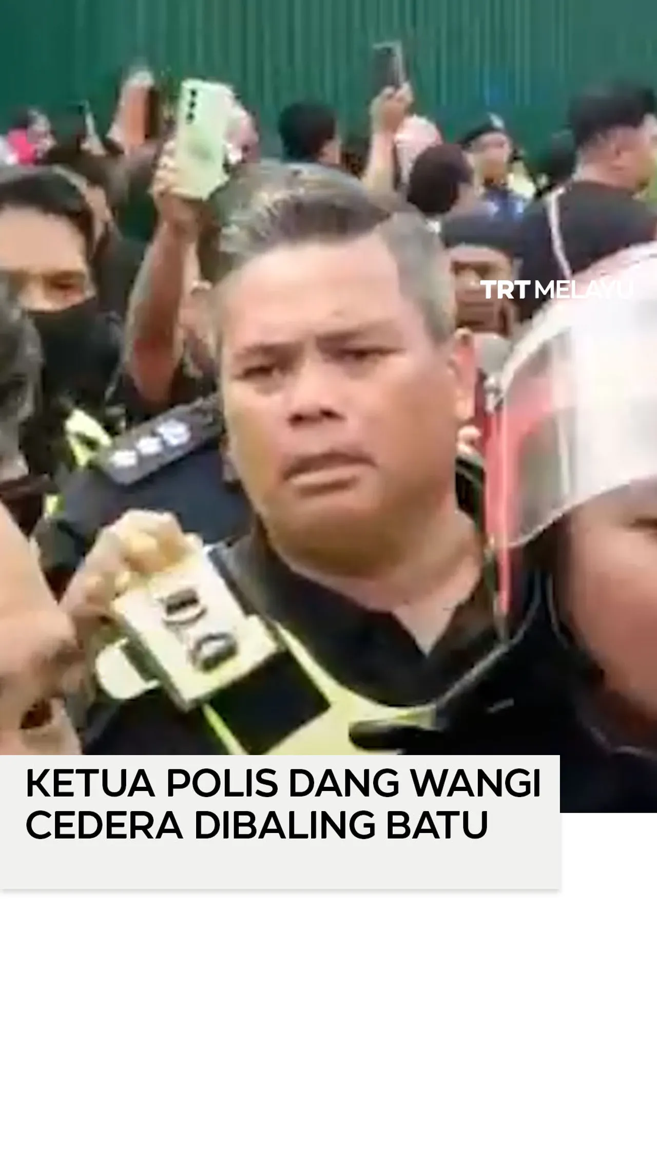 Ketua Polis Dang Wangi cedera dibaling batu