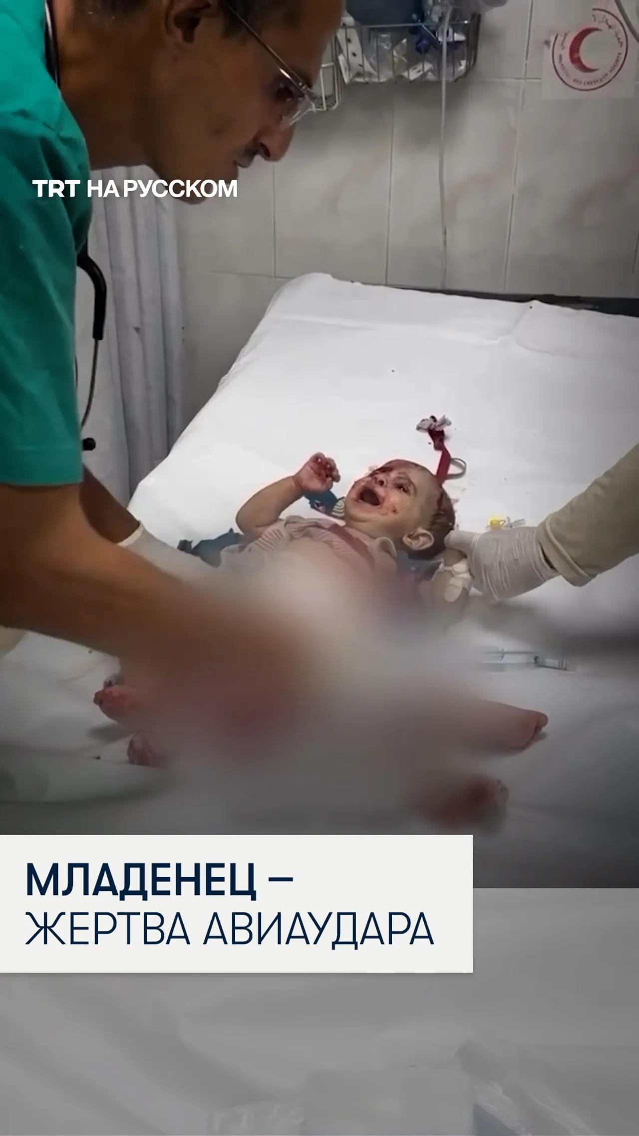 Пострадавший от израильского удара младенец плачет от боли