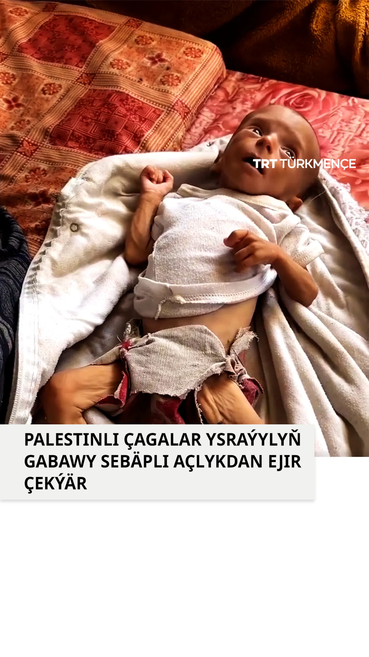 Palestinli çagalar Ysraýylyň gabawy sebäpli ejir çekýär