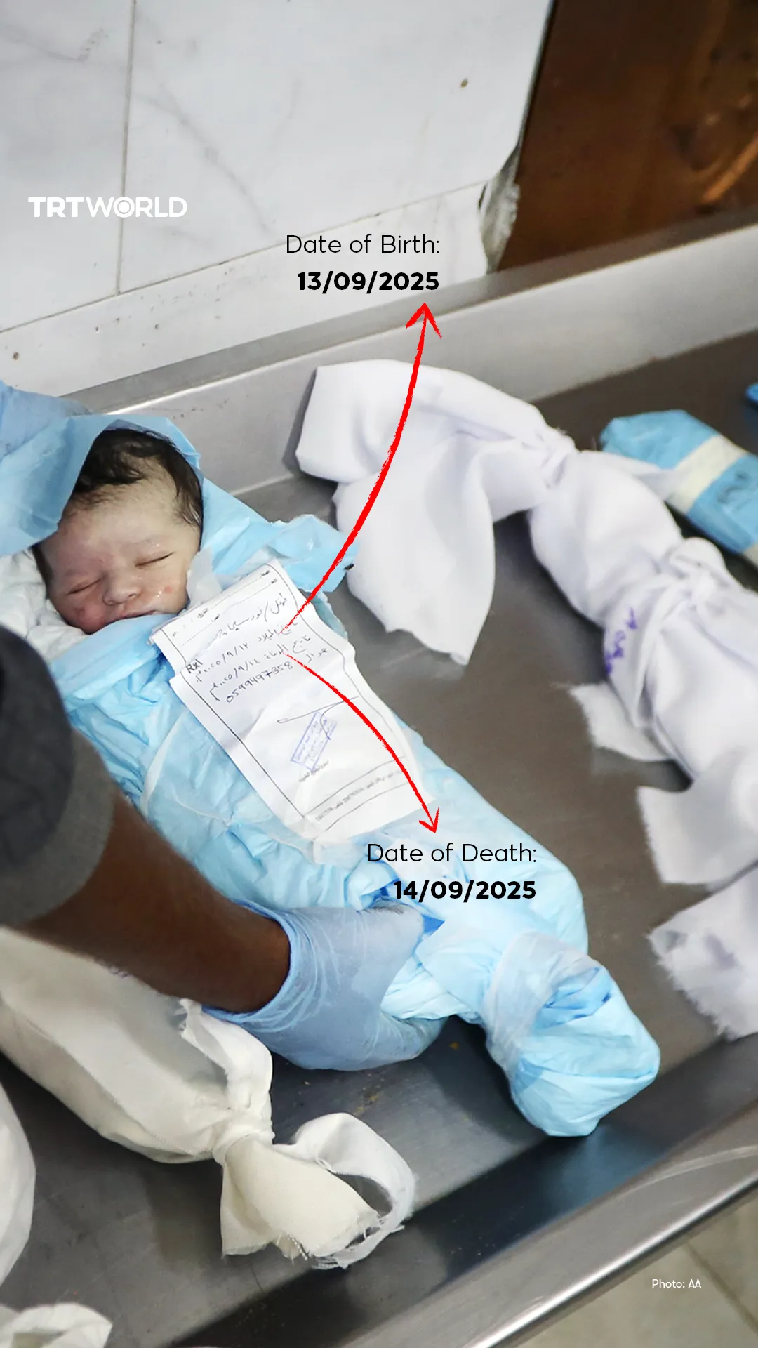 Infant deaths, miscarriages: Israeli war on Gaza's newborns