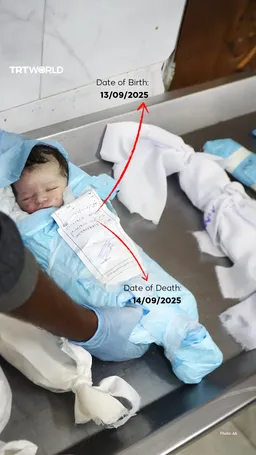 Infant deaths, miscarriages: Israeli war on Gaza's newborns