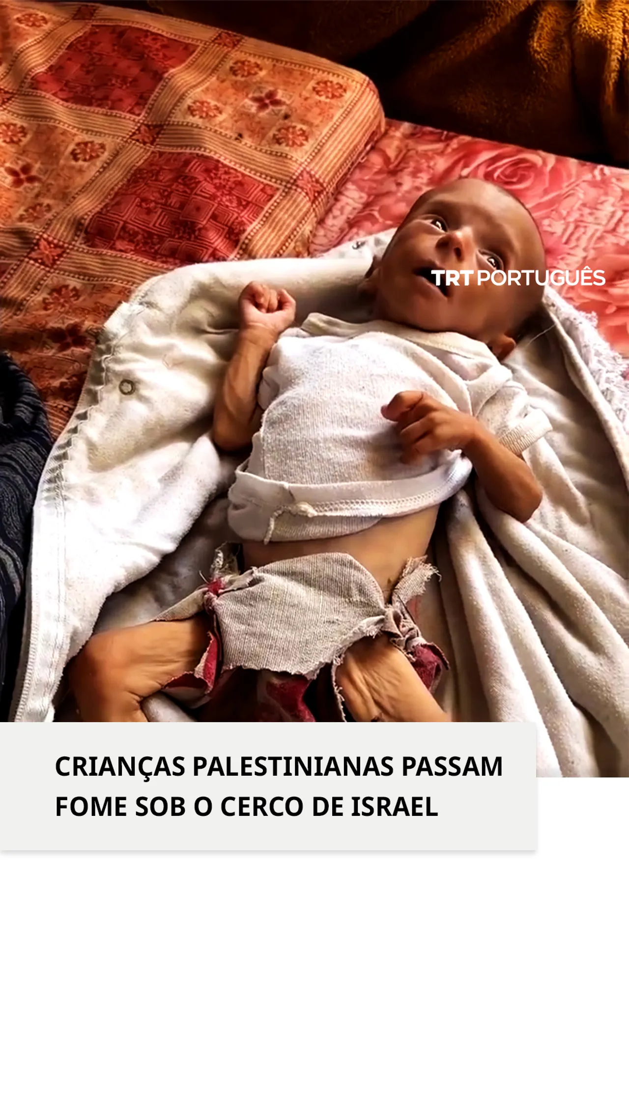 Crianças palestinianas passam fome sob o cerco de Israel