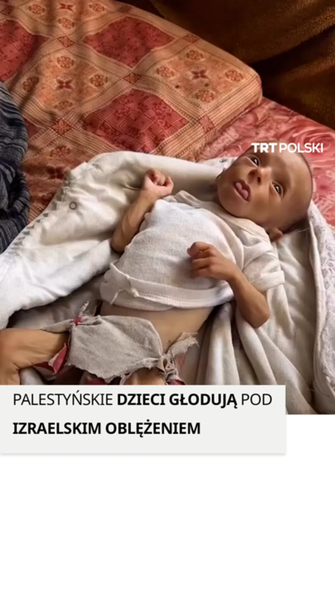 Palestyńskie dzieci głodują pod izraelskim oblężeniem