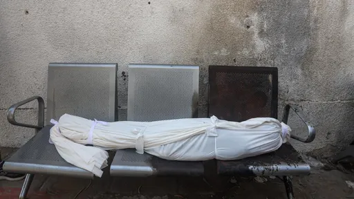 شمار جان‌باختگان حملات اسرائیل به غزه از ۶۵ هزار نفر گذشت