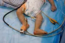 Gaza records 185 deaths from starvation in August