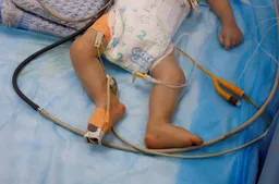 Gaza records 185 deaths from starvation in August