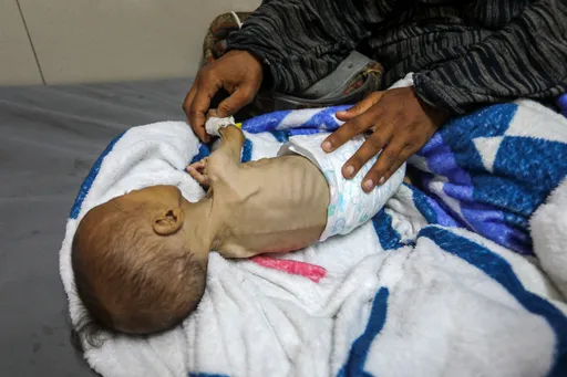 UNRWA: Një në tre fëmijë nën 3 vjeç në Gaza i ka kaluar 24 orët e fundit pa ushqim